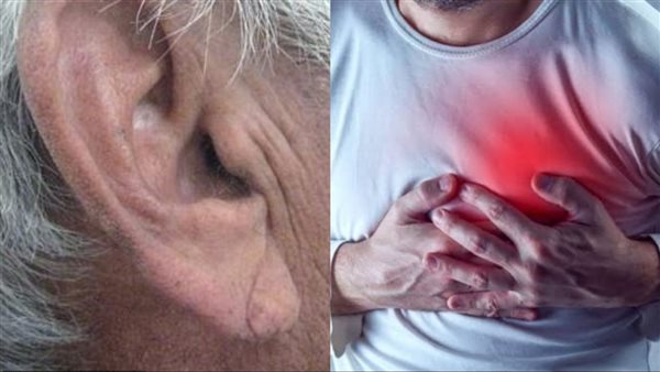  حالة علامة فرانك