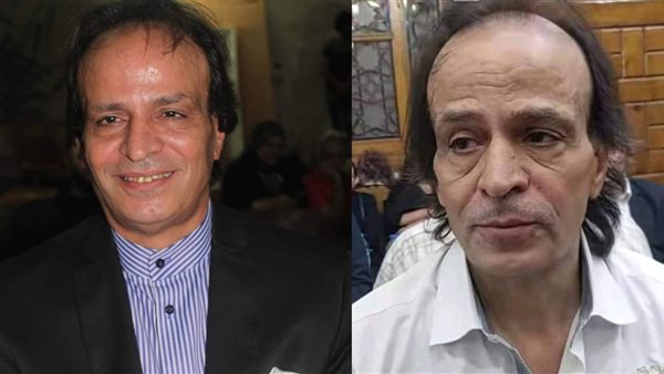 عبده الوزير