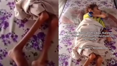 الحقوني قبل فوات الأوان.. استغاثة أب فلسطيني لمساعدة صغيره المريض بضمور المخ