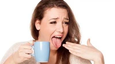 أبرز العلاجات المنزلية لتخفيف حروق الفم.. تعرف عليها 