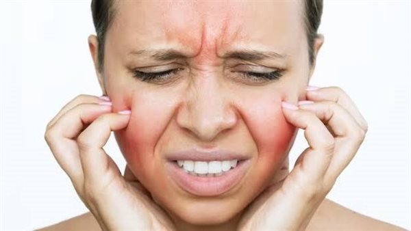 انتفاخ الوجه