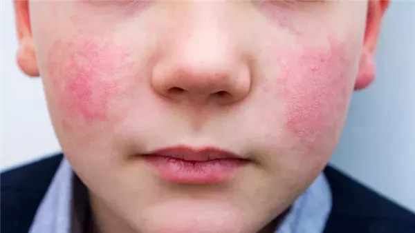  صورة تعبيرية 