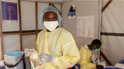 بعد اكتشاف أول حالة خارج إفريقيا.. مخاوف من انتشار جدري القرود