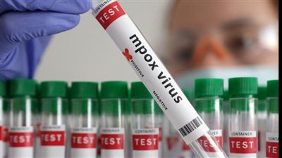 بعد ألمانيا.. إسبانيا تتبرع بـ 500 ألف جرعة من لقاح جدري القرود لمكافحة تفشي المرض في إفريقيا