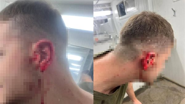 الجنود المصابة 