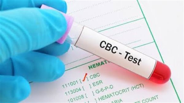 فحوصات الدم 