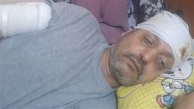 أسرة سيدة تعتدي على شقيق زوجها بالغربية.. والضحية: خدت 130 غرزة وعايز حقي | بث مباشر 