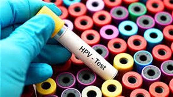 فيروس الورم الحليمي