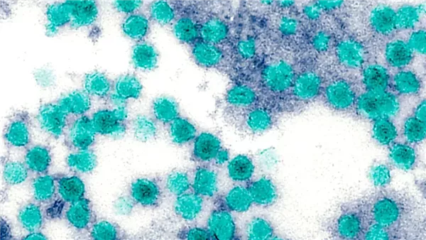 النورفيروس 