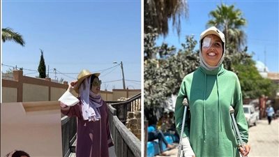 فقدت عينها وقدمها.. فلسطينية تستغيث لعلاجها: غالبية الفلسطينيين يعانون من بتر الأعضاء| خاص