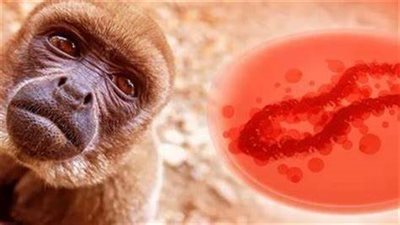 مستشفى جامعة بنها ينفي تسجيل حالات إصابة بجدري القرود | بث مباشر