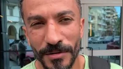 حسام عرفات بعد حادث بلع لسانه وخروجه من المستشفى: بطمن والدي ووالدتي ربنا كتبلي عمر جديد| بث مباشر 