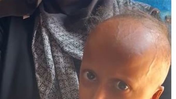 معاناة أطفال غزة