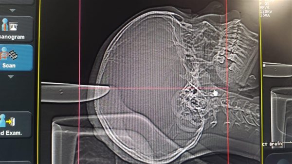 اطباء الأقصر ينقذون