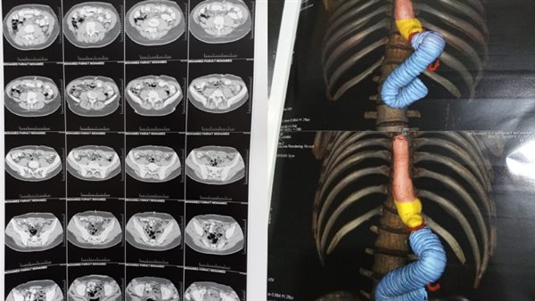 شاب يتعرض لإهمال