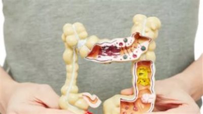 وصفة للإمساك بملينات طبيعية فورية.. تخلص منه في 3 دقائق فقط