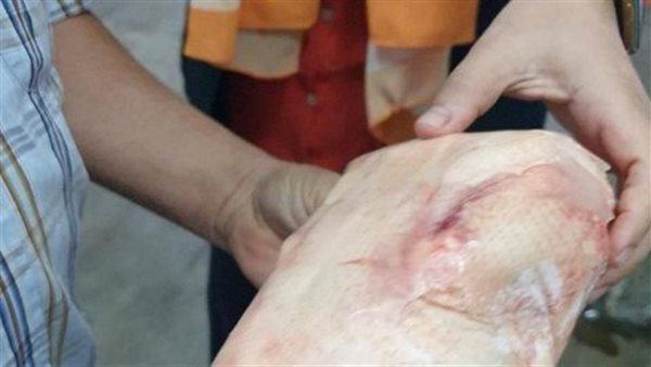 جانب من الحملة