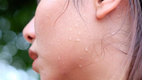 أسباب التعرق الزائد