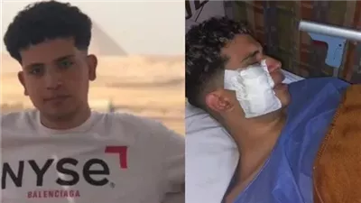 الحبس سنة للمتهم بإصابة زميله طالب التجمع بعاهة مستديمة