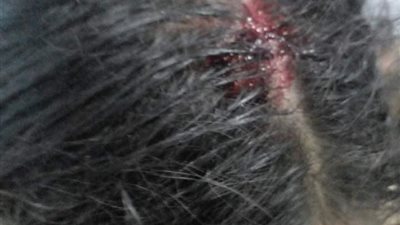 الجهات المعنية تنقذ فتاة وأخواتها بعد تعذيبهن من عمهن وعمتهن بالفيوم 