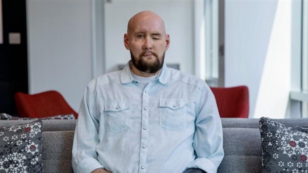  صورة تعبيرية 