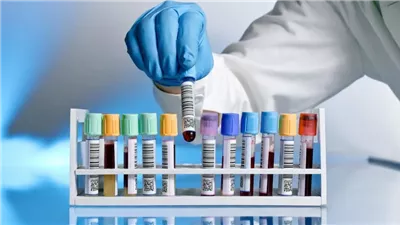 بعد معامل كايرو كلينكال.. سيتي للتحاليل الطبية تدرس الاستحواذ على شركة جديدة 