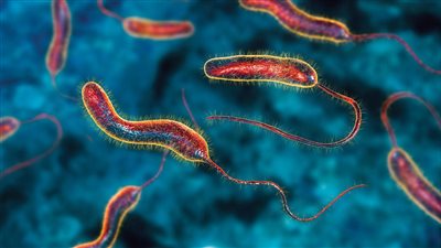 الكونغو تشهد ارتفاعًا كبيرًا في إصابات الكوليرا والجدري