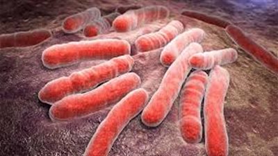 طرق الوقاية من الإصابة بالبكتيريا الإشريكية؟.. تعرف عليها