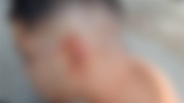 المجني عليه