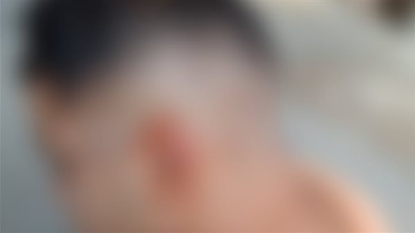 المجني عليه 