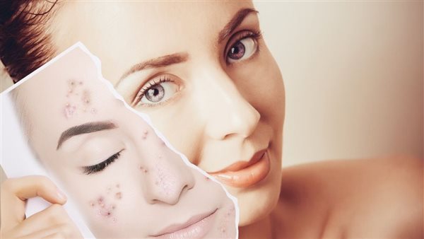 كيفية استخدام ماء