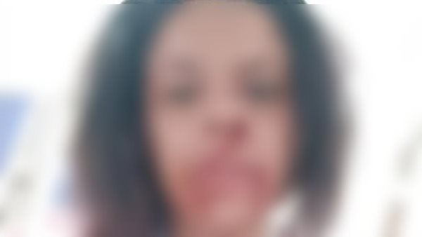 السيدة المصابة