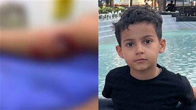 يجري عملية جراحية.. إصابة صغير عقره كلب حراسة داخل كمبوند بالقاهرة الجديدة