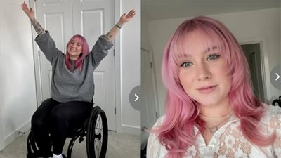 25 نوبة صرع يوميا.. ضغط العمل يصيب بريطانية بفقدان قدرتها على المشي والتحدث