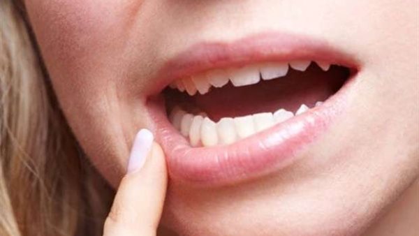 صحة الفم والأسنان