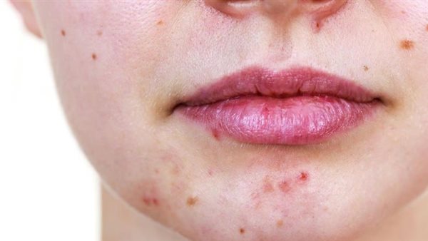  صورة تعبيرية 