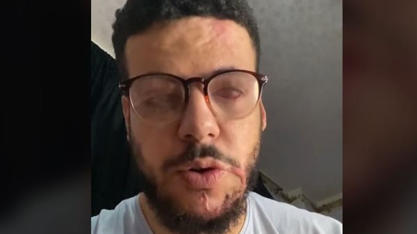 شاب يتعرض لحادث مأساوي