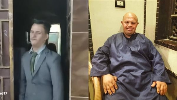 المصابون بمتلازمة