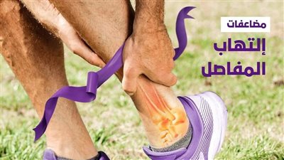 الرعاية الصحية ببورسعيد تكشف 5 مضاعفات لـ التهاب المفاصل