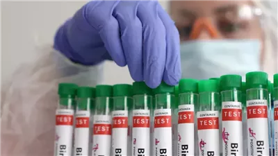 نفوق الأبقار بشكل كبير في كاليفورنيا بسبب أنفلونزا الطيور 