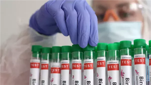 أنفلونزا الطيور