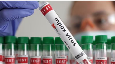 أول إصابة محلية بسلالة جديدة من جدري القرود في بريطانيا تثير القلق