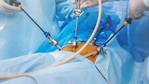 جراحات السمنة 