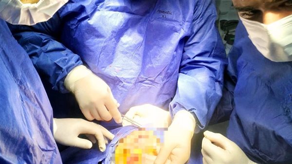 جانب من الجراحة 