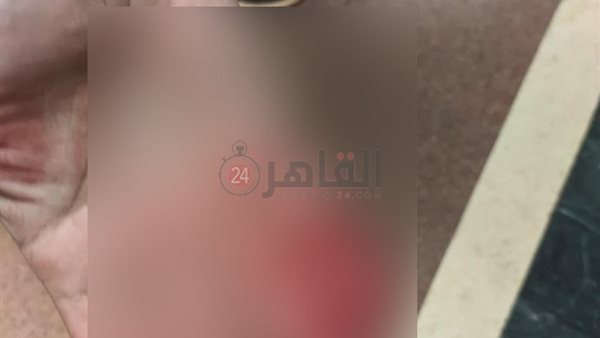 جانب من الواقعة