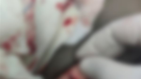 جانب من التعدي