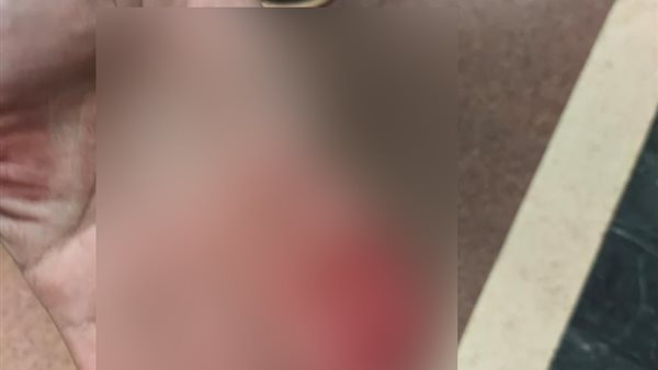 جانب من واقعة التعدي