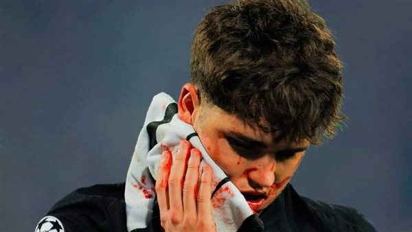 باو كوبارسي