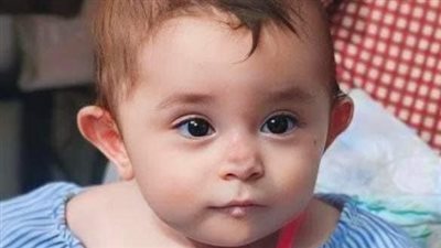 أب يستغيث لعلاج ابنته المصابة بمرض جلدي نادر: علاجها في أمريكا ومحتاجين تسهيل لإجراءات السفر