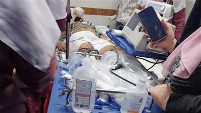 قلبه توقف مرتين والوضع حرج.. وكيل صحة دمياط يكشف تفاصيل حالة اللاعب محمد شوقي